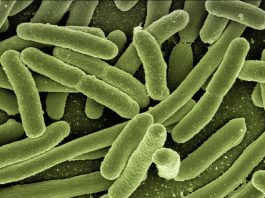 Sesto, valori anomali di Legionella: interventi all’impianto idrico del nido Rodari