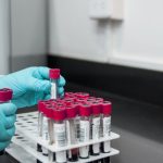 Laboratrio-provette-test sierologici