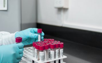 Laboratrio-provette-test sierologici